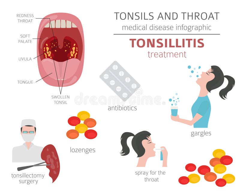 Tonsils And Throat Diseases Tonsillitis Symptoms Treatment Icon Set