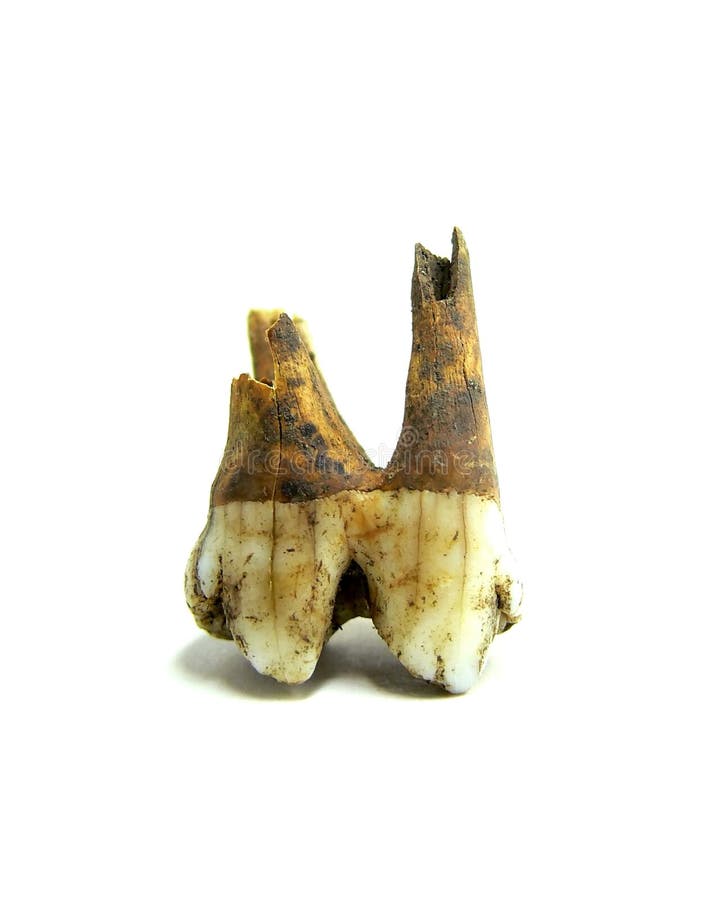 A rotten tooth on a white background.