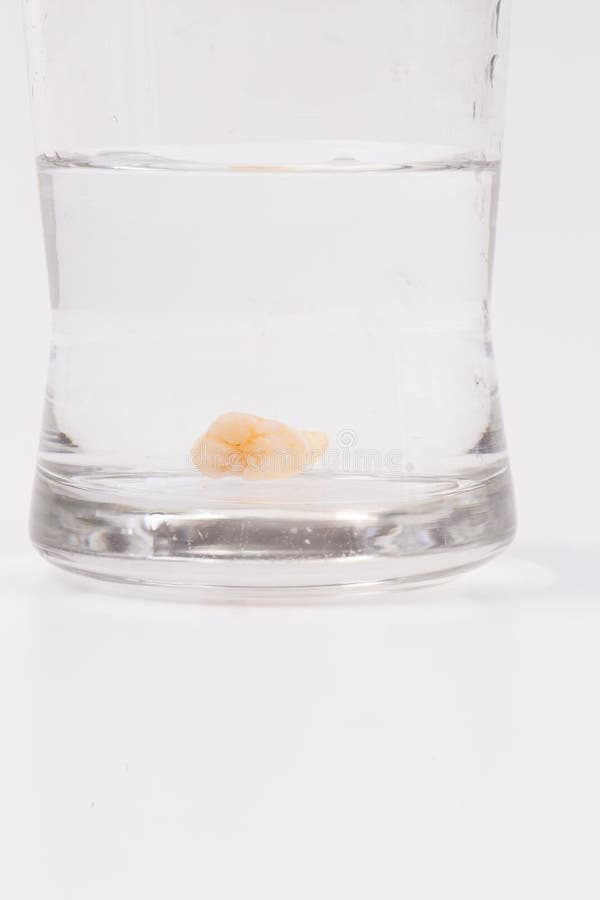 Tooth Decay in a Glass of Water Stock Image Image of hand, extractive