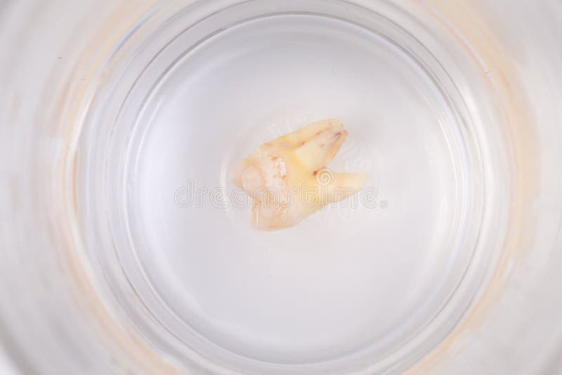 Tooth Decay in a Glass of Water Stock Image Image of isolated