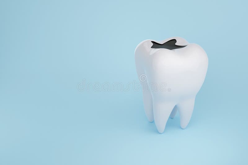 https://thumbs.dreamstime.com/b/tooth-decay-isolated-blue-background-tooth-decay-isolated-blue-background-dental-concept-d-rendering-247935740.jpg