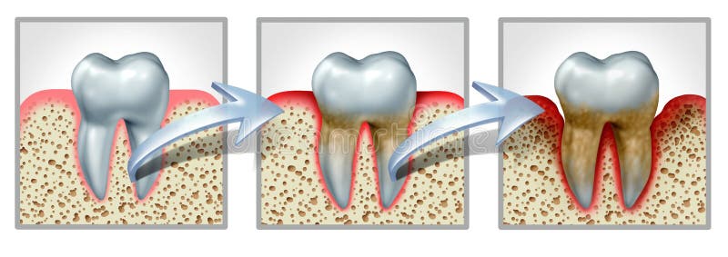 Популярные заболевания зубов и десен