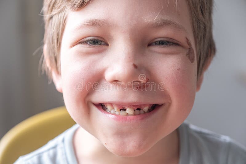 Toothless boy smiling stock photo. Image of human, person 