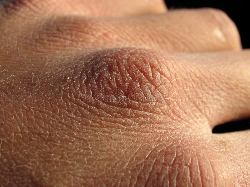 A hand with dry skin. A hand with dry skin