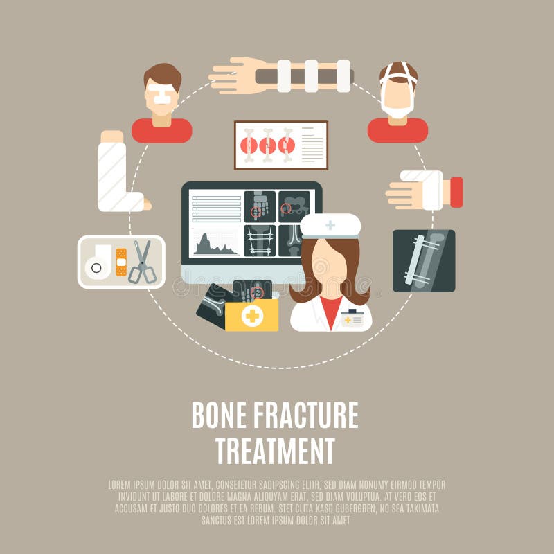 Traitement d'os de fracture illustration stock Traitement d'os de fracture illustration stock