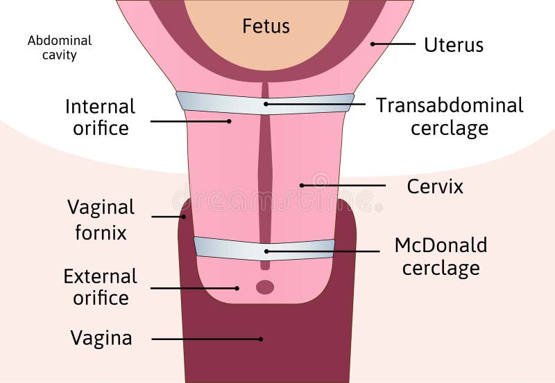 Layers Of Cervix