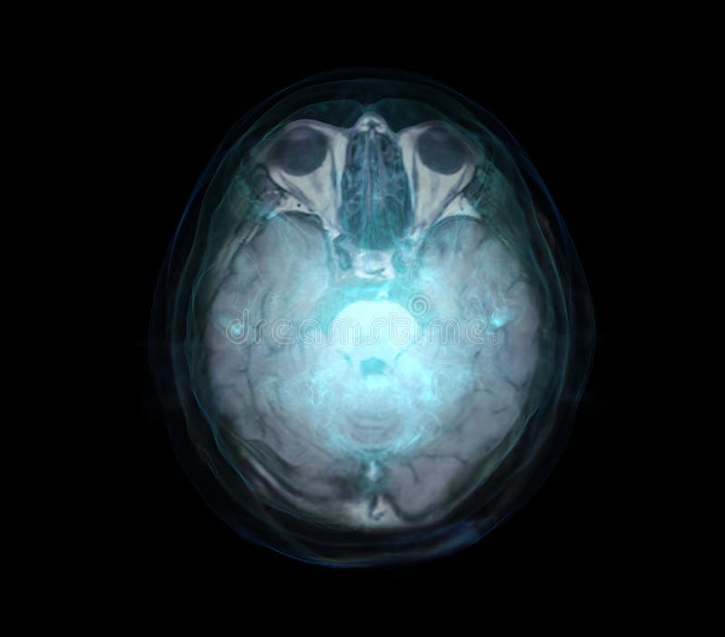 Transparent image of the Skull  with  Brain for medical background concept