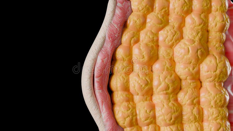 Trasformazione corporea. prima e dopo che la pancia grassa brucia sotto il processo di perdita di peso del tessuto adiposo della p fotografie stock libere da diritti