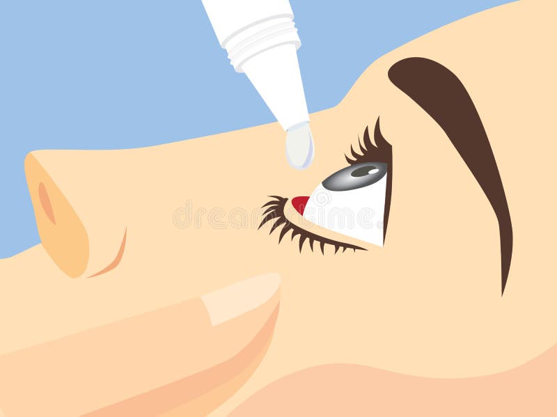 Trattamento dell'occhio con i collirii illustrazione vettoriale Trattamento dell'occhio con i collirii illustrazione vettoriale