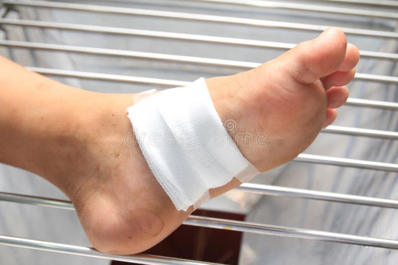 Treating Patients with Foot Ulcers Stock Photo Image of care, cover