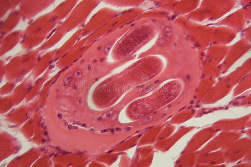 Trichinella spiralis larvae in muscle tissue under the microscope.