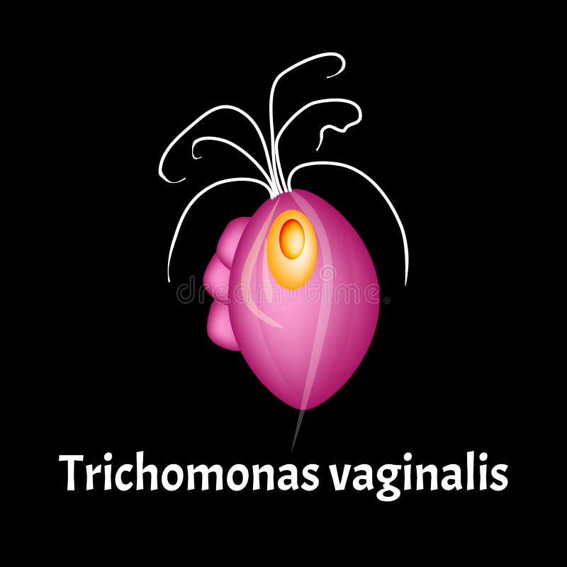 gonococcus Trichomonas vaginalis szal)