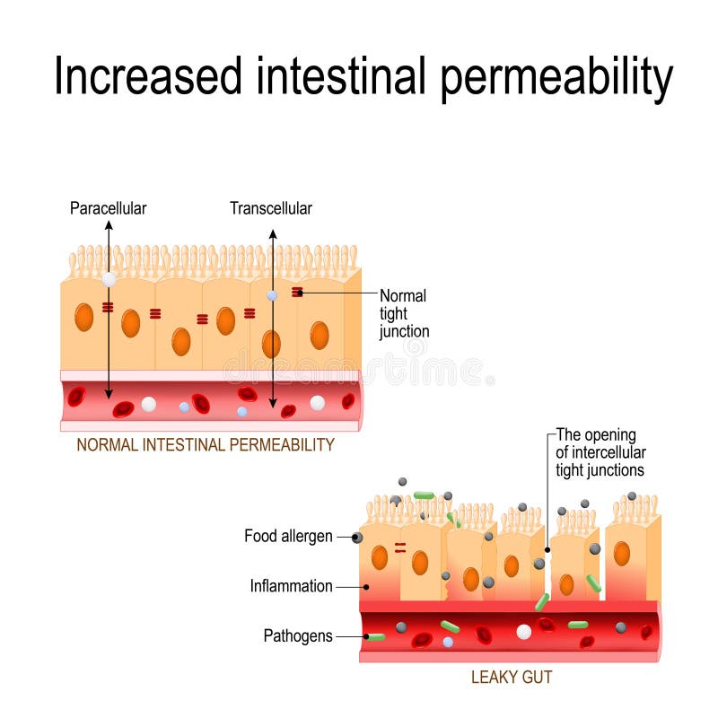 Tripa permeable La abertura de empalmes apretados intercelulares aumentó permeabilidad intestinal libre illustration Tripa permeable La abertura de empalmes apretados intercelulares aumentó permeabilidad intestinal libre illustration