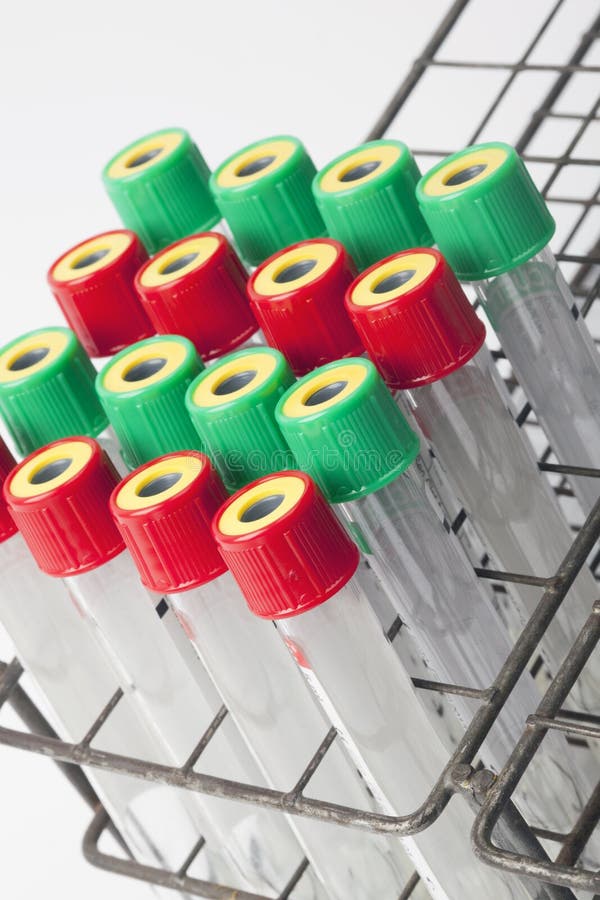 Blood tubes stock photo. Image of medical, chemical, research 74258