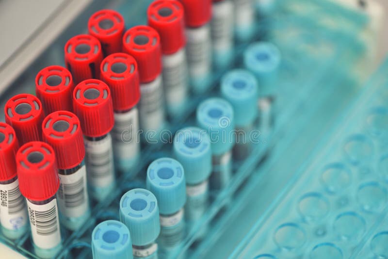 Tubes of blood sample for testing. Medical equipment stock images Tubes of blood sample for testing. Medical equipment stock images