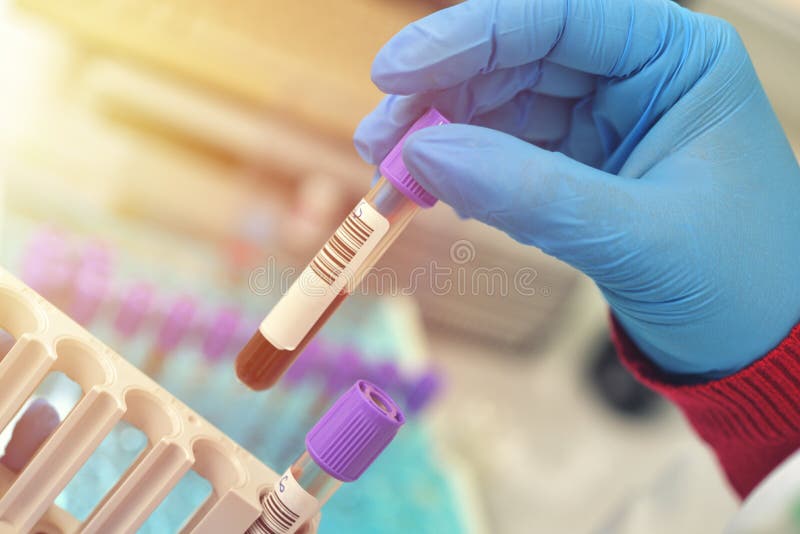 Tubes of Blood Sample for Testing. Medical Equipment Stock Image