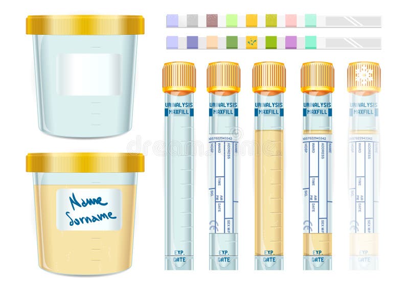 Detailed illustration of a Urinalysis Yellow Cap Tubes Set, empty, filled, frozen and dipistick. This illustration is saved in EPS10 with color space in RGB. Detailed illustration of a Urinalysis Yellow Cap Tubes Set, empty, filled, frozen and dipistick. This illustration is saved in EPS10 with color space in RGB.