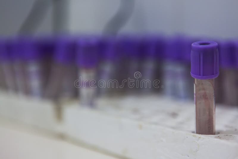 Tubi clinici di analisi, utilizzati solitamente per le analisi del sangue immagine stock Tubi clinici di analisi, utilizzati solitamente per le analisi del sangue immagine stock