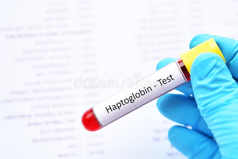 Tubo da amostra de sangue para o teste do haptoglobin foto de stock Tubo da amostra de sangue para o teste do haptoglobin foto de stock