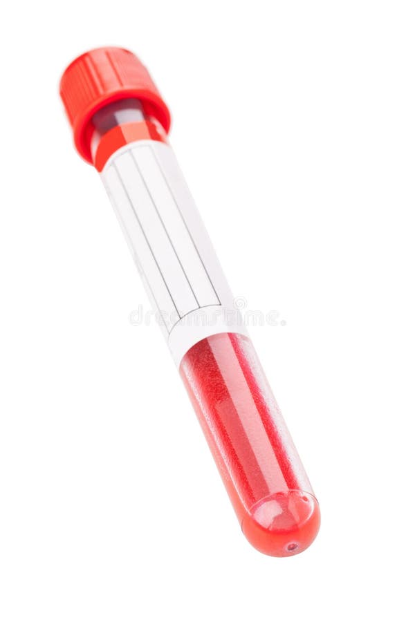 Tubo de ensayo de la muestra de sangre foto de archivo libre de regalías Tubo de ensayo de la muestra de sangre foto de archivo libre de regalías