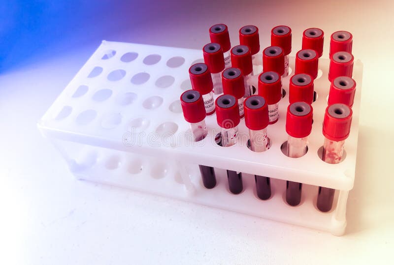 Tubos da amostra de sangue para testes de laborat?rio imagens de stock Tubos da amostra de sangue para testes de laborat?rio imagens de stock