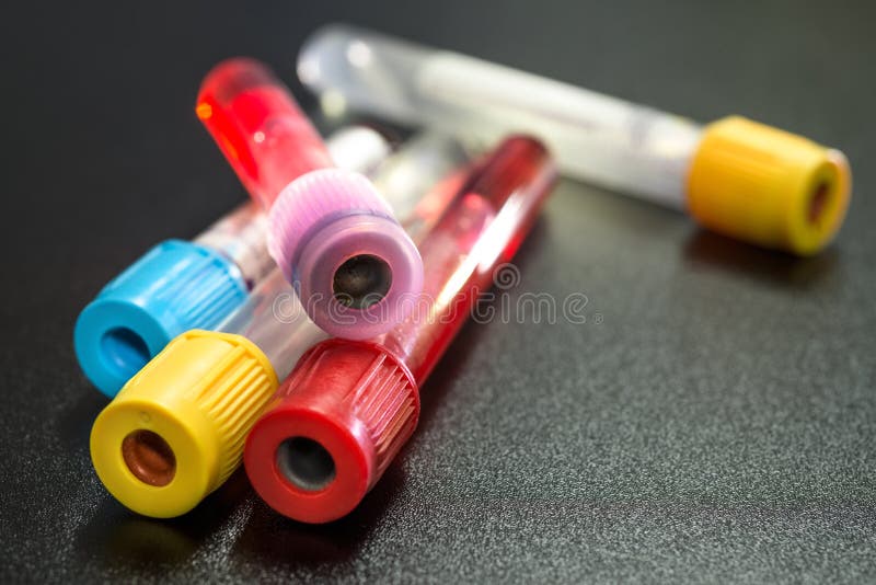 Tubos de vácuo para recolher amostras de sangue fotos de stock Tubos de vácuo para recolher amostras de sangue fotos de stock