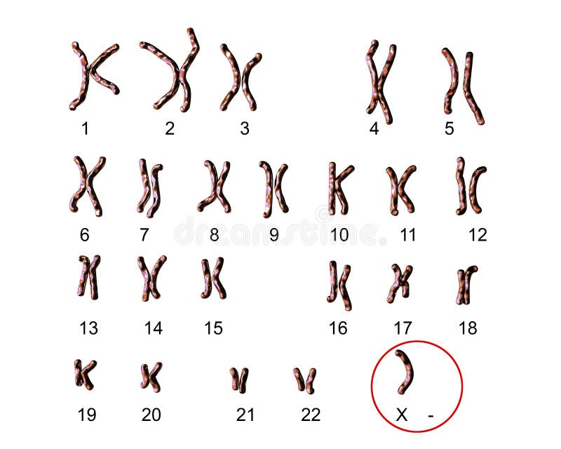 Turner S-syndrome Karyotype Stock Illustration - Illustration of macro,  molecule: 81634526