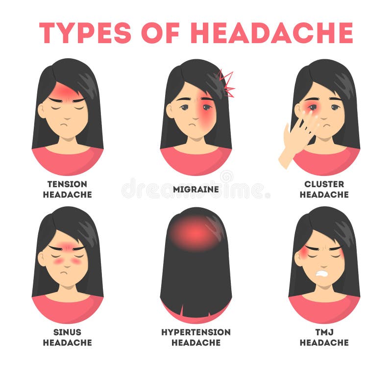 Sinus Headache Location Chart