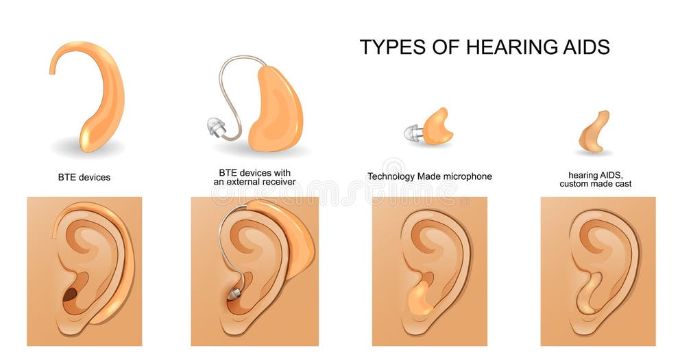 Hearing Aids Stock Illustrations 394 Hearing Aids Stock Illustrations