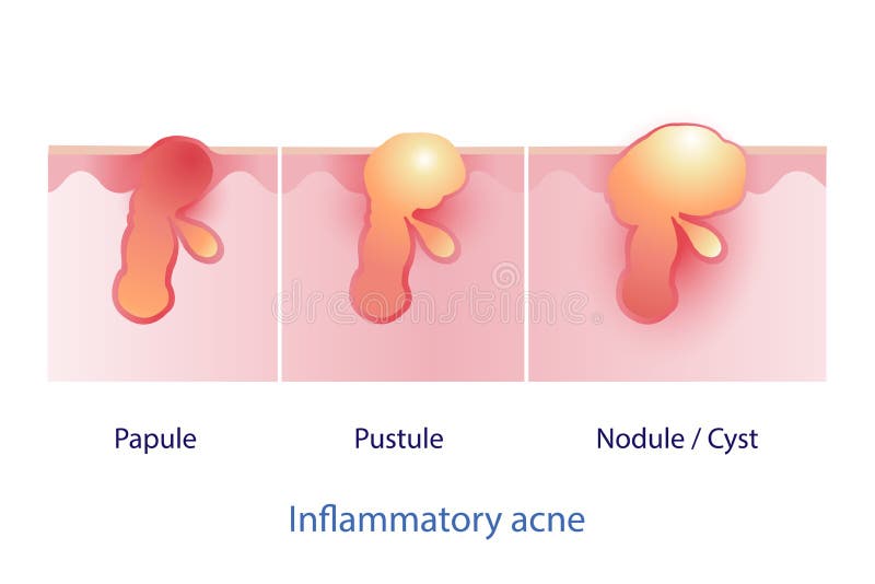 Types Glands Stock Illustrations – 41 Types Glands Stock Illustrations ...