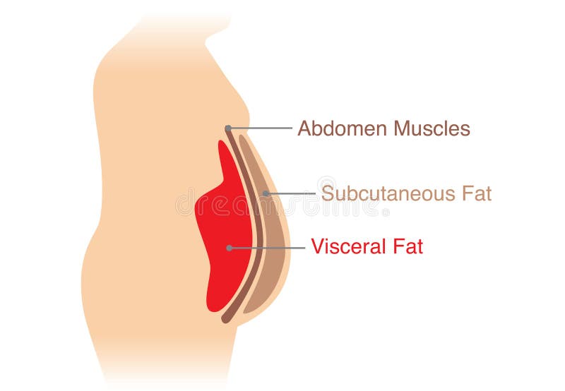 Location of Visceral fat stored within the abdominal cavity. Illustration about medical diagram. Location of Visceral fat stored within the abdominal cavity. Illustration about medical diagram.