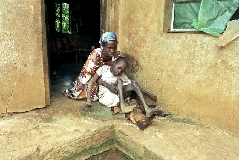 Uganda, Luweero district, village Kalasa: a woman takes loving care of her physically and mentally disabled child in front of their home. The skewing of her child is hard work for the woman and painful for the boy, who has a face distorted in pain. Uganda, Luweero district, village Kalasa: a woman takes loving care of her physically and mentally disabled child in front of their home. The skewing of her child is hard work for the woman and painful for the boy, who has a face distorted in pain.