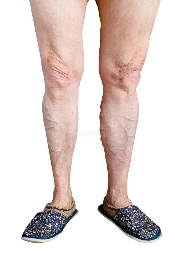 Legs Granny Hd Foto