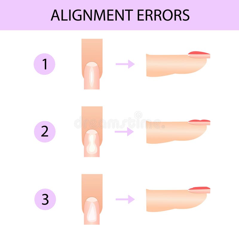 Alignment of the nail plate. Professional manicure guide, illustration, infographics. Alignment of the nail plate. Professional manicure guide, illustration, infographics