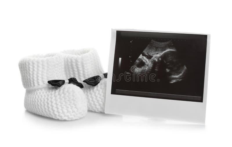 Ultraschallfoto und Babyschuhe auf weißem Hintergrund stockbild Ultraschallfoto und Babyschuhe auf weißem Hintergrund stockbild