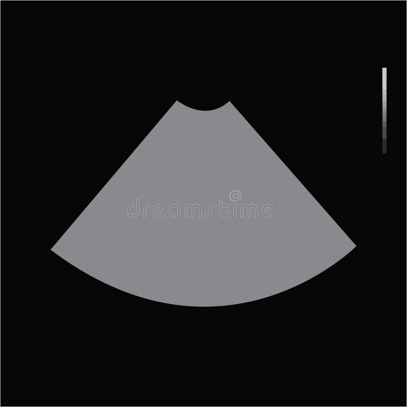 Blank Ultrasound Template Blank Ultrasound Template