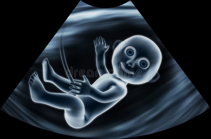 Ultrasound Image of Funny Baby Stock Illustration - Illustration of infant, motherhood: 23442312 Ultrasound Image of Funny Baby Stock Illustration - Illustration of infant, motherhood: 23442312