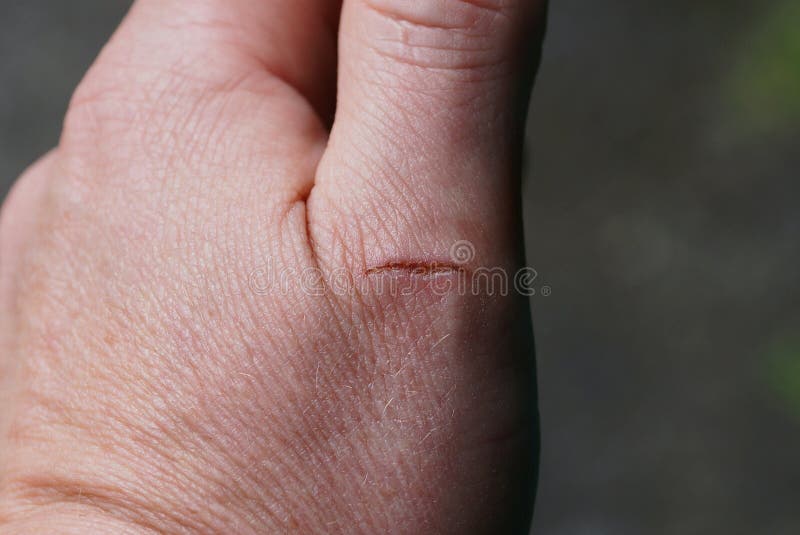 Um Corte No Dedo De Um Homem Imagem de Stock - Imagem de macro