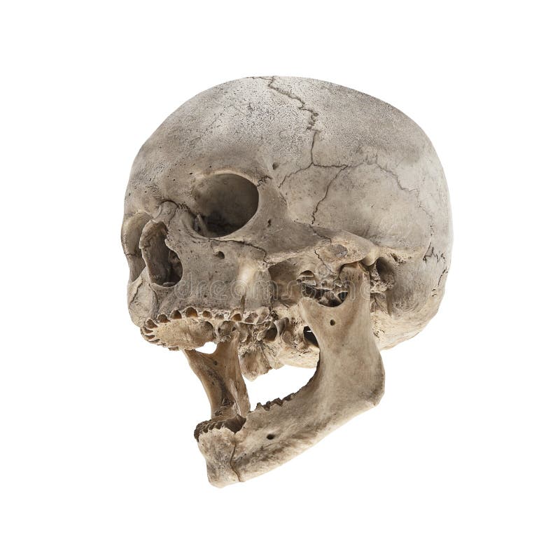 Um crânio humano velho com uma maxila sem dentes imagem de stock Um crânio humano velho com uma maxila sem dentes imagem de stock