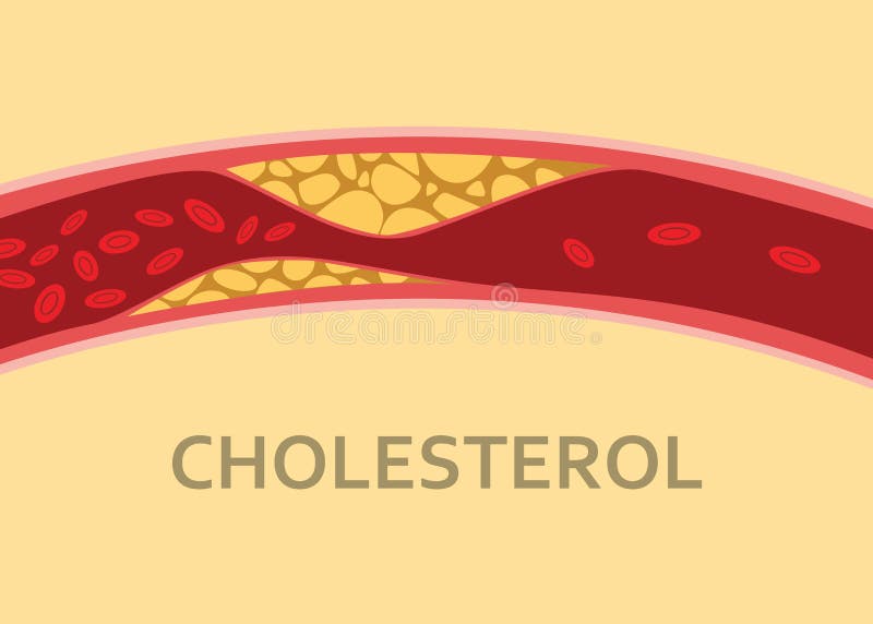 Uma veia do corpo humano do colesterol com córrego do glóbulo ilustração stock Uma veia do corpo humano do colesterol com córrego do glóbulo ilustração stock