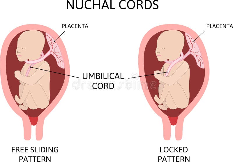 umbilical cord diagram