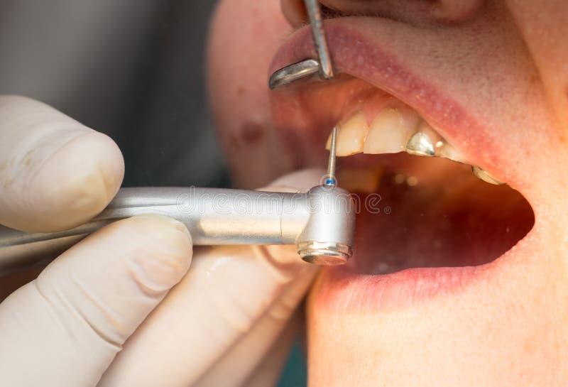 Un dentista hace los dientes a una mujer imagen de archivo Un dentista hace los dientes a una mujer imagen de archivo