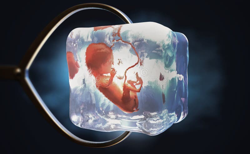 Un foetus cryopreserved congelé dans le glaçon s'est tenu par des pinces en métal illustration de vecteur Un foetus cryopreserved congelé dans le glaçon s'est tenu par des pinces en métal illustration de vecteur