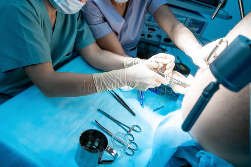 Un gruppo di chirurghi che effettuano interventi di chirurgia poco invasiva sull'ano dei pazienti utilizzando strumenti chirurgici