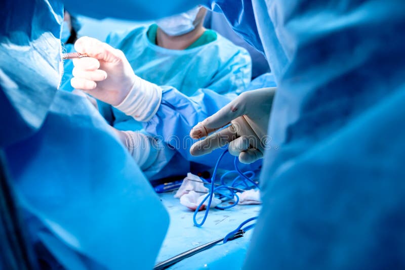 Un gruppo di chirurghi che effettuano interventi di chirurgia poco invasiva sull'ano dei pazienti utilizzando strumenti chirurgici