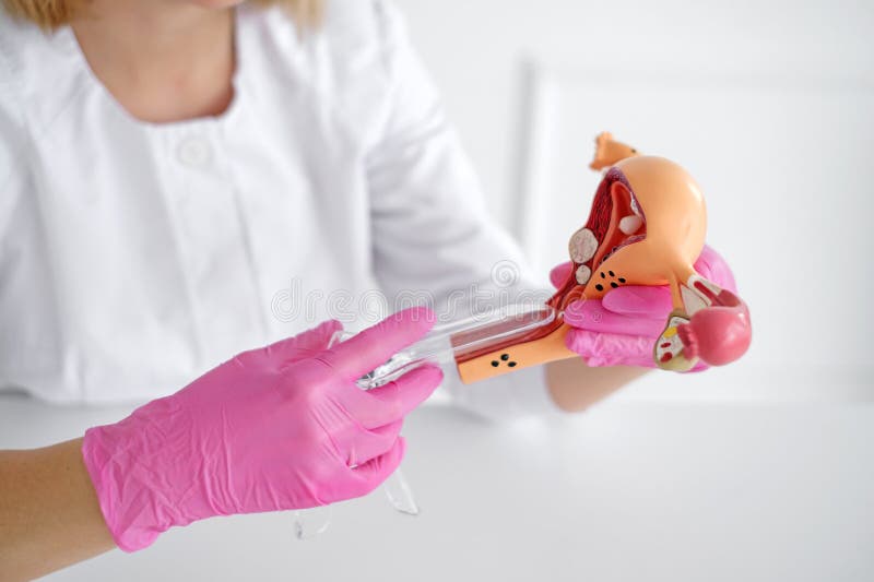 Un gynécologue praticien montre aux élèves le processus d'introduction du speculum gynécologique pour examen photos libres de droits