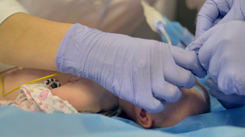 Un nourrisson inconscient dans la vue étroite pendant la préparation de chirurgie clips vidéos