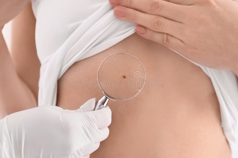 Undersökande patient för hudspecialist med förstoringsglaset i kliniken, closeup arkivbild Undersökande patient för hudspecialist med förstoringsglaset i kliniken, closeup arkivbild