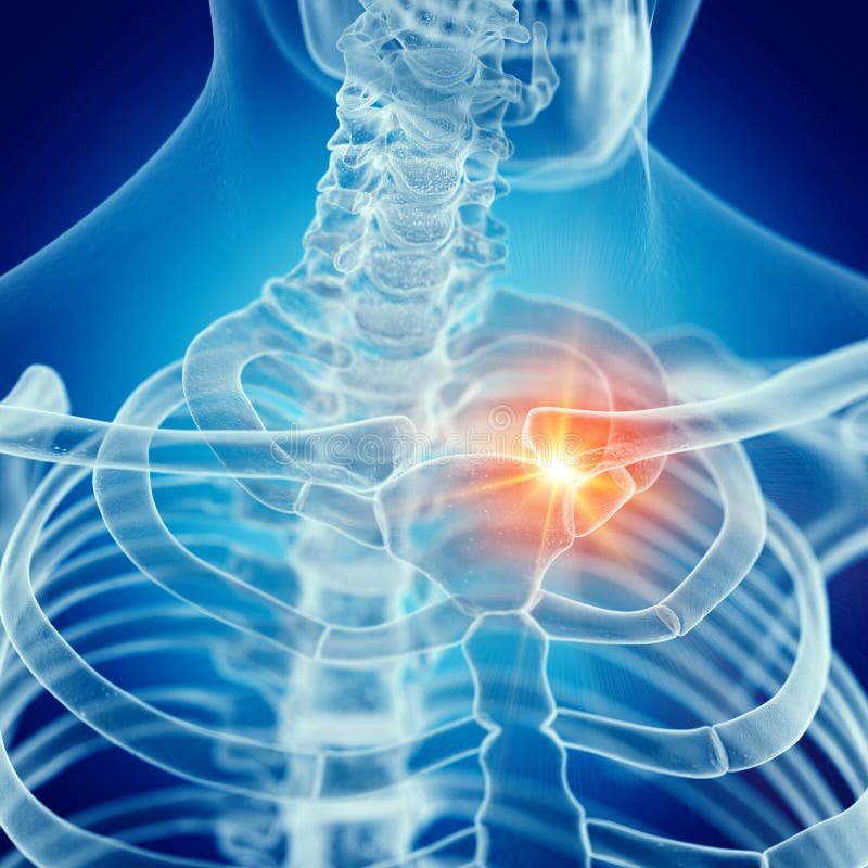 Une clavicule douloureuse illustration stock. Illustration du