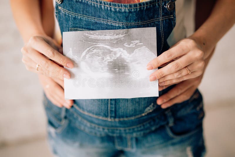 Une fille enceinte tient une photo d'ultrason près de l'abdomen, Th photo stock Une fille enceinte tient une photo d'ultrason près de l'abdomen, Th photo stock